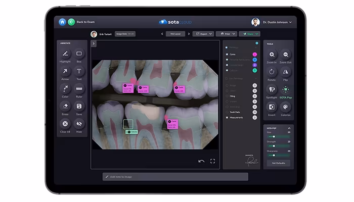 Sota Cloud Intelligent Imaging with A.I Capabilities