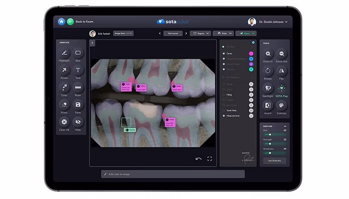 Sota Cloud Intelligent Imaging with A.I Capabilities