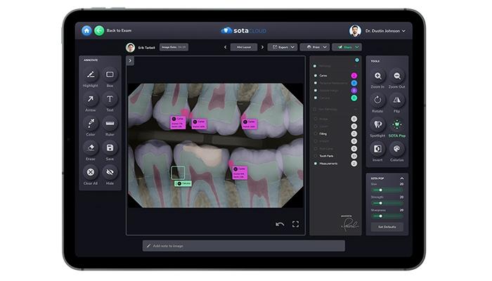 Sota Cloud Intelligent Imaging with A.I Capabilities