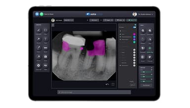 Sota Cloud Intelligent Imaging with integrated A.I Capabilities