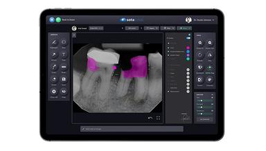 Sota Cloud Intelligent Imaging with integrated A.I Capabilities