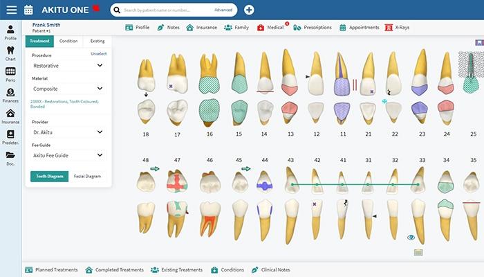 Teeth Charting with Akitu One is more easy and comprehensive.