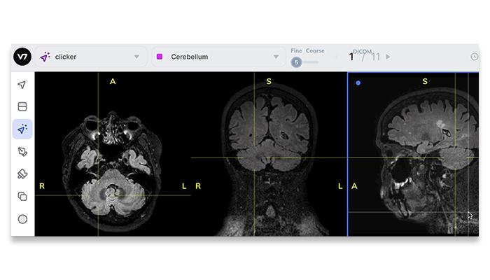 Auto Split Medical Imaging Views