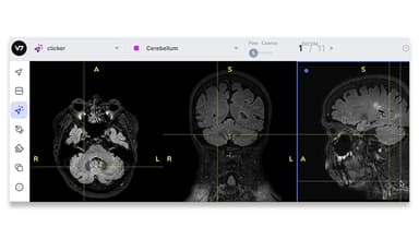 Auto Split Medical Imaging Views