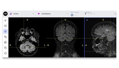 Auto Split Medical Imaging Views