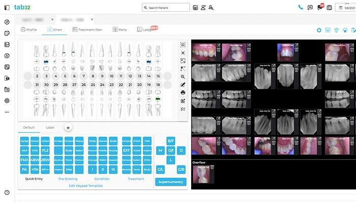 tab32 Patient's Chart & X rays