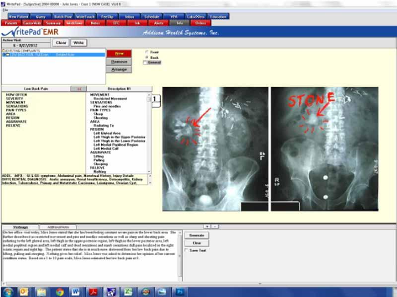 WritePad Software Pricing, Features, Reviews & Demo